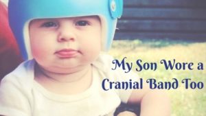 baby wearing cranial band Providence Moms Blog