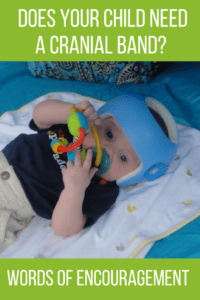 cranial band providence moms blog